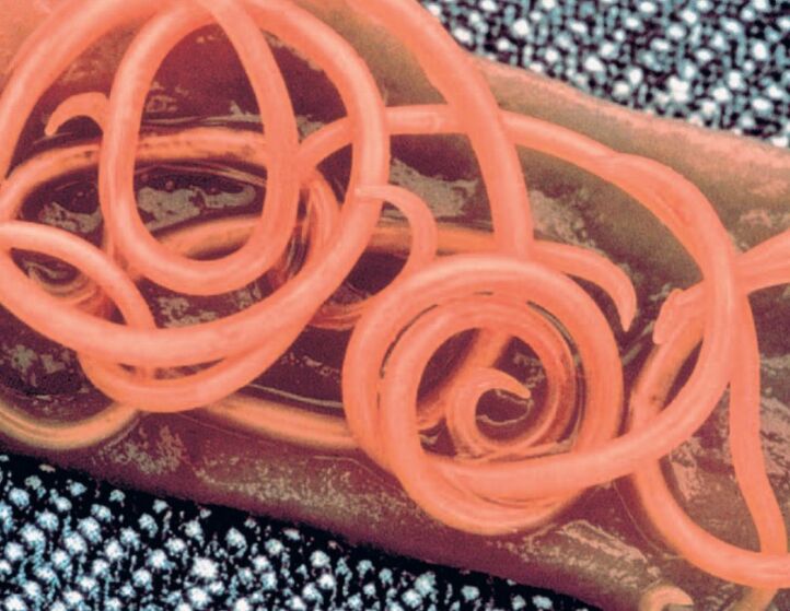 tapeworms of the human body