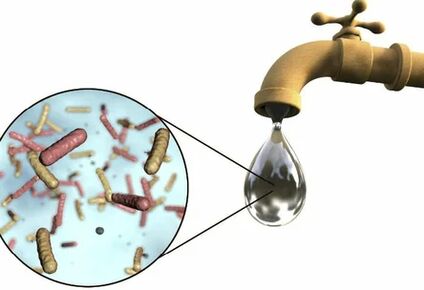 Parasites in a drop of crane water
