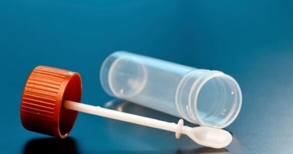 Parasite tests